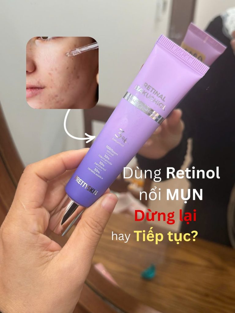 3 Sai lầm dùng retinol